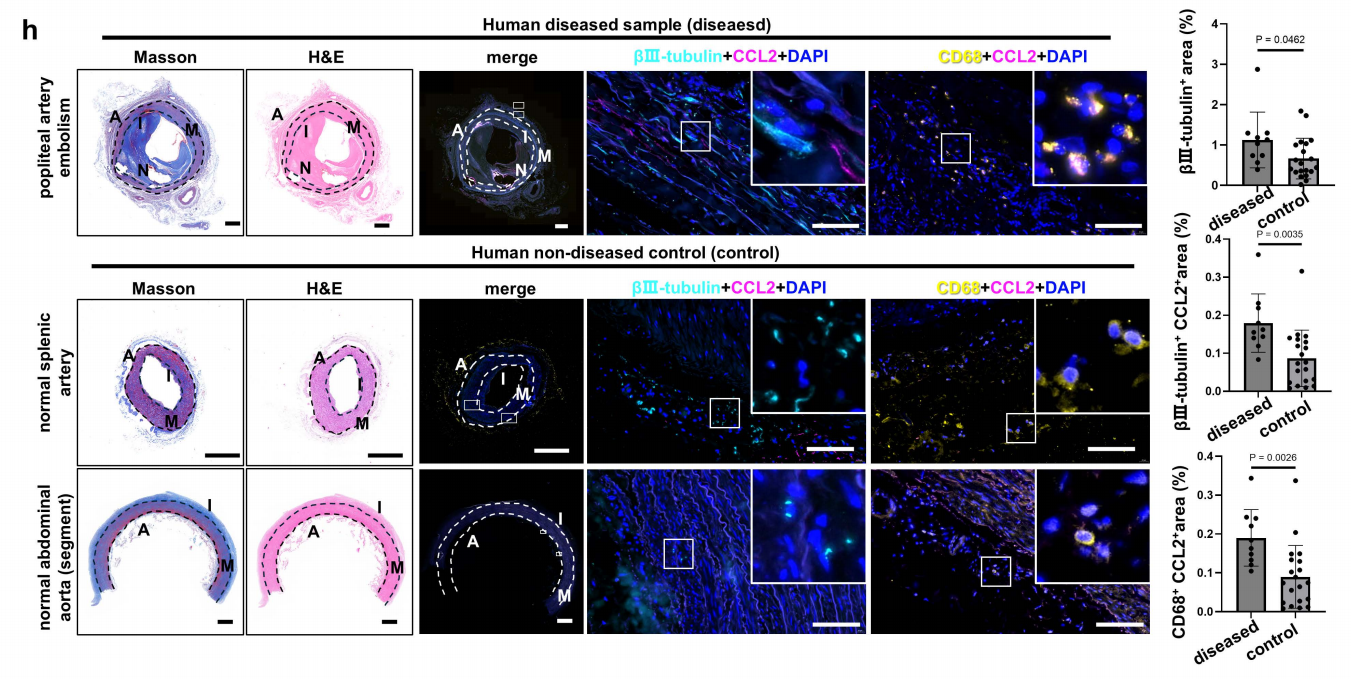 49dea056b428a20263f3025a62b97de9